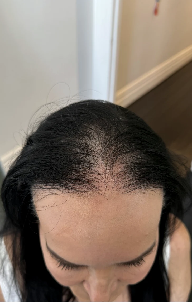 A client&rsquo;s widening part before women&rsquo;s SMP