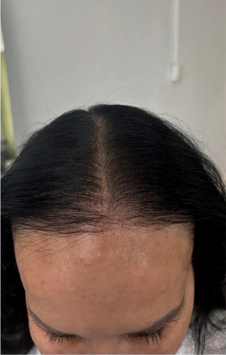 The same client after women&rsquo;s SMP