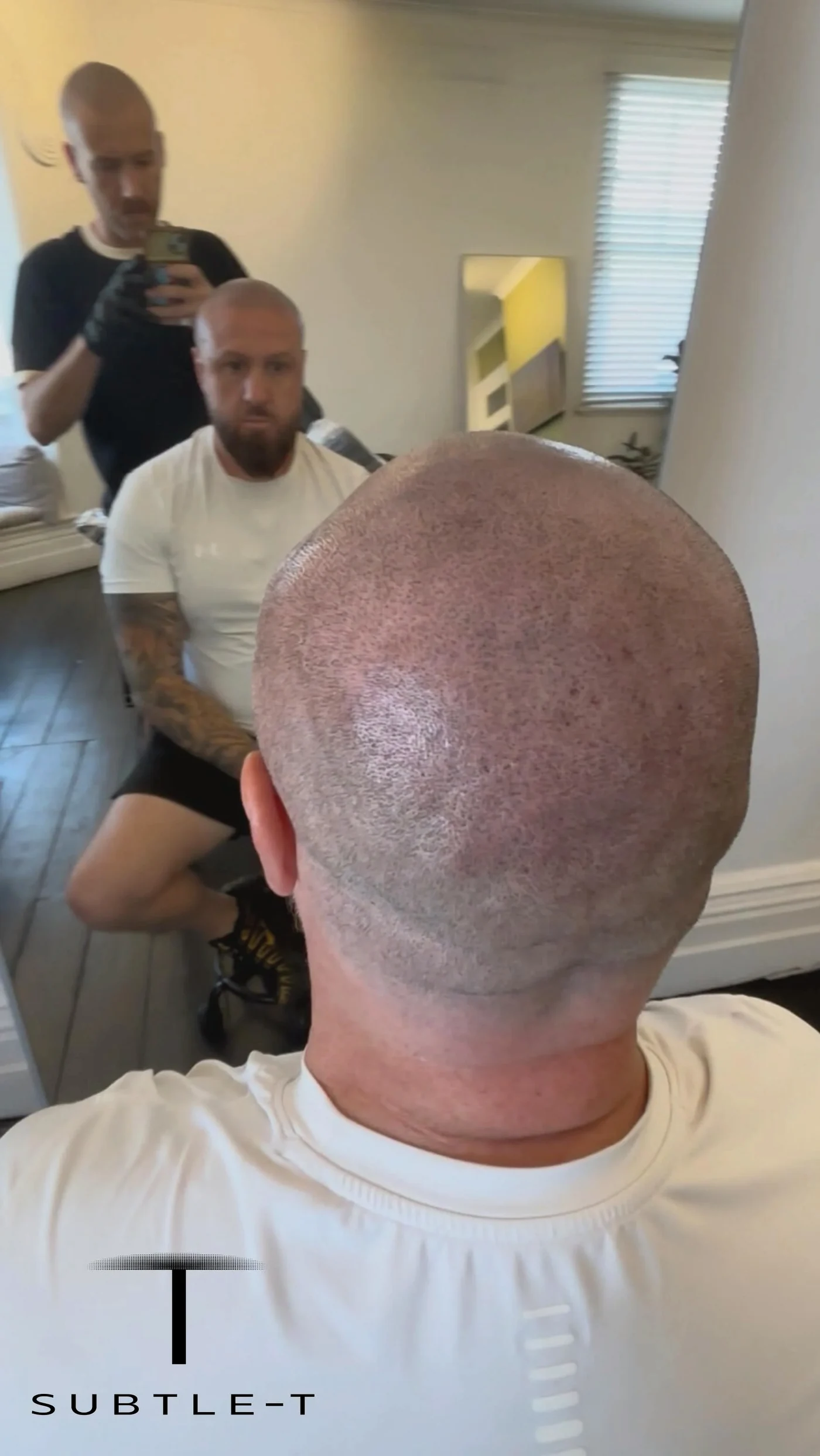 The back of a client&rsquo;s head after SMP