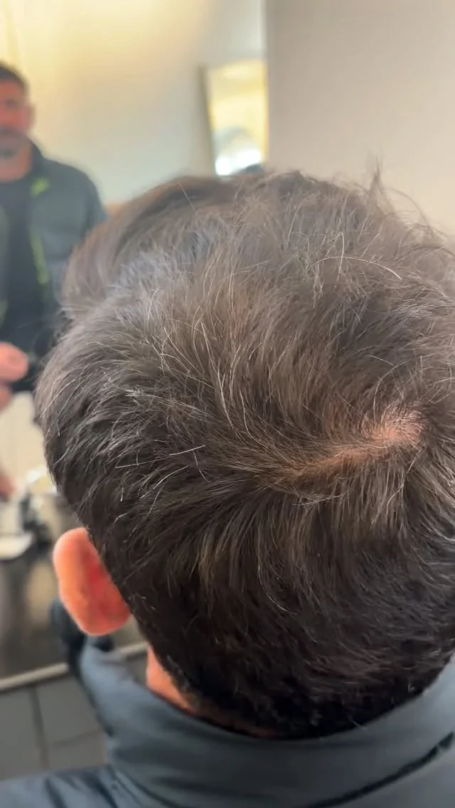 A client&rsquo;s crown before density work